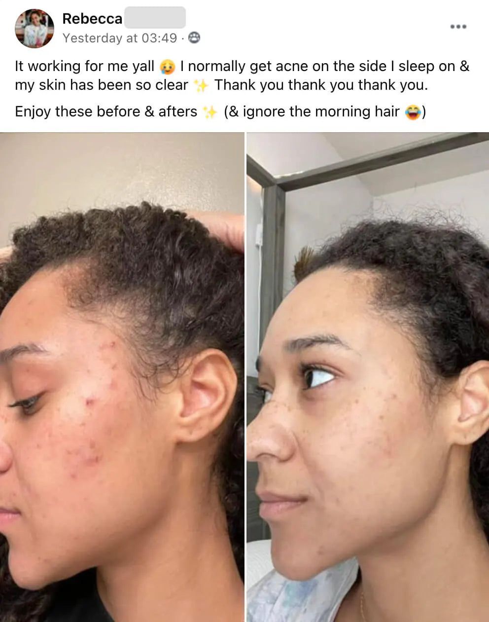 CozyRest® Silk Pillow Case (2 Pack)