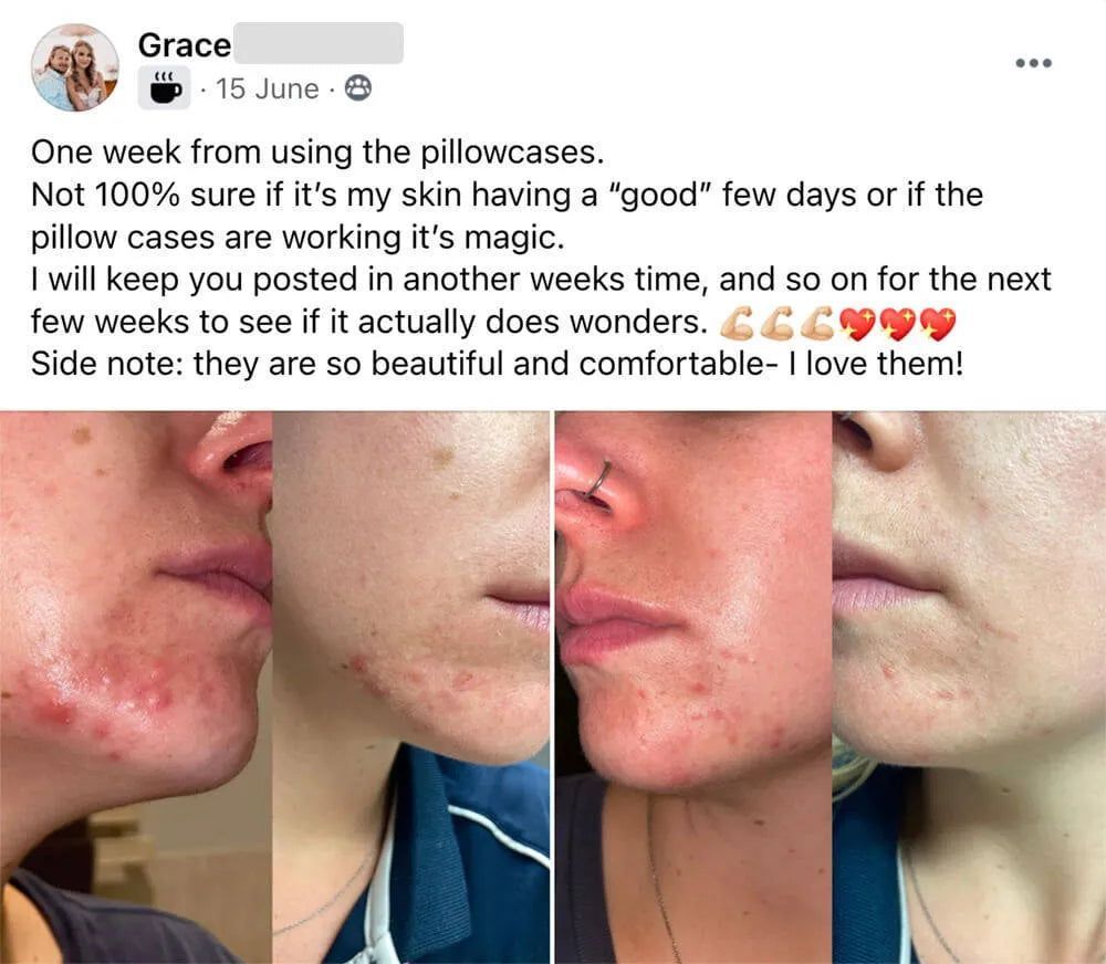 CozyRest® Silk Pillow Case (2 Pack)