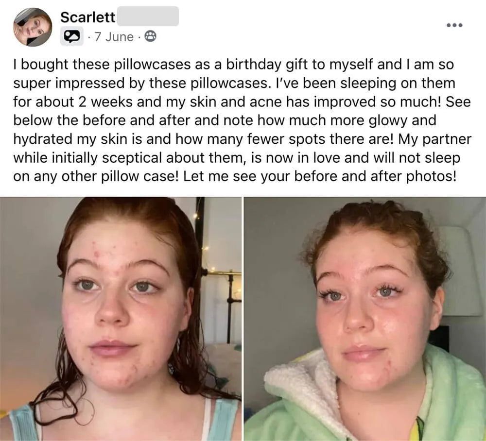 CozyRest® Silk Pillow Case (2 Pack)